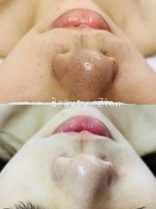 Beauty Zion所属・Beauty Zionのエステ・リラクイメージ