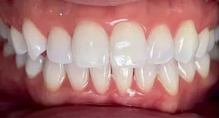 サクッとホワイト都立大学店所属・Koma Minamiのその他イメージ