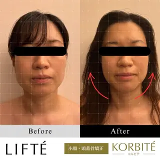 I Norikoのエステ・リラクイメージ