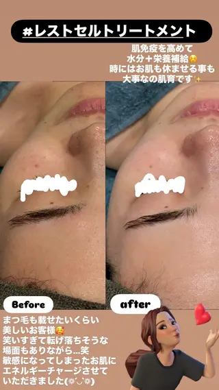 LiZA エステティックサロンのエステ・リラクイメージ