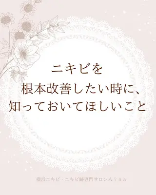 ミディアム カラー パーマ ヘアアレンジ メンズ キッズ ネイル マツエク・マツパ アイブロウ ニキビ跡専門サロン Ainaのエステ・リラクイメージ