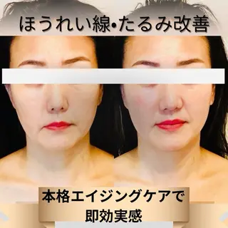 美肌エイジングケアサロンIB所属・ＩＢ 内藤のエステ・リラクイメージ