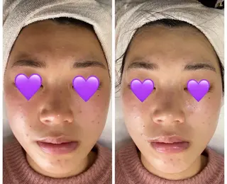 De I'm トータルビューティーサロン所属・COCO beautyサロンのエステ・リラクイメージ