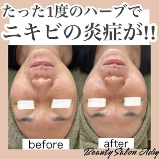 Beauty   Salon  Adiy所属・Adiy ikumiのエステ・リラクイメージ