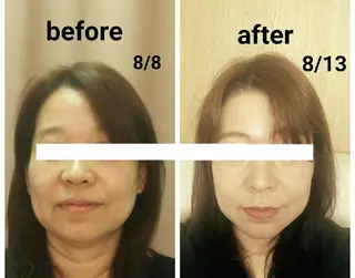 小顔と美肌 まごころエステMatoria所属・小顔 美肌専門 Matoriaのエステ・リラクイメージ