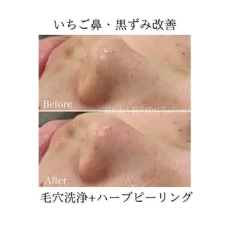 Rich+ ビューティーサロンのエステ・リラクイメージ