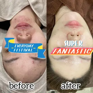 laluna saki...のその他イメージ