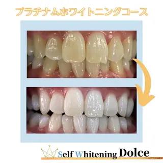セルフホワイトニング Dolce八王子店のその他イメージ