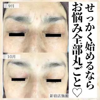 シミケア・肌改善専門 トリニエンス浦和店のエステ・リラクイメージ
