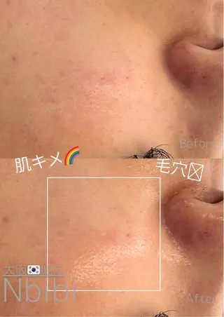 韓国🇰🇷価格 サロン_Nbibiの眉毛・アイブロウイメージ