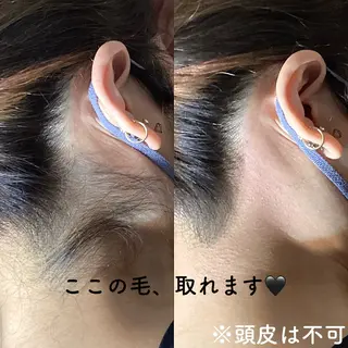 うなじラボ(UNAJI LABO)所属・池袋脱毛 さとうのエステ・リラクイメージ