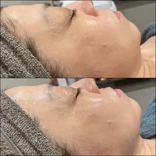 LiZA エステティックサロンのエステ・リラクイメージ