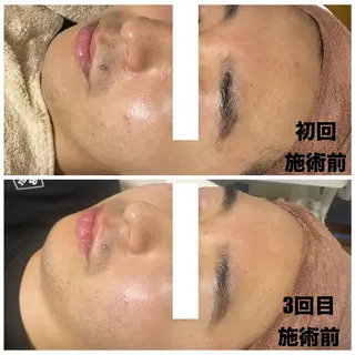 メンズ Linoa所属・Linoa（リノア） エステ&リラクのエステ・リラクイメージ