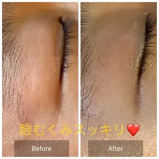 Mandarin Orange所属・毛穴から始める肌メン テマンダリンオレンジのエステ・リラクイメージ