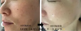 🩵Tatsumi Kana🩵のエステ・リラクイメージ