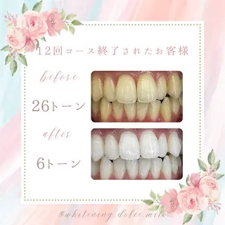 セルフホワイトニング Dolce八王子店のその他イメージ