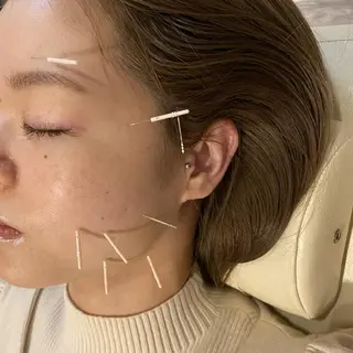 むくみたるみ専門☆ 美容鍼・小顔矯正のエステ・リラクイメージ