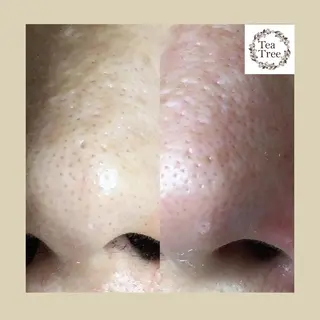 枝廣 貴子のエステ・リラクイメージ