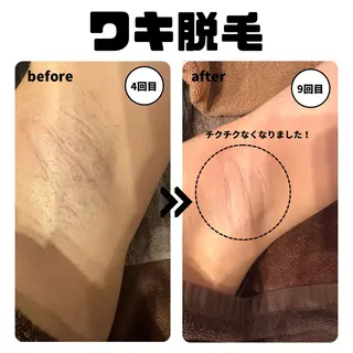 ローザエメ Reiaのエステ・リラクイメージ