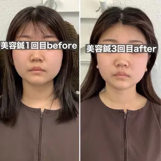 hari salon de off 美容鍼灸×小顔整体【ハリサロンドオフ】所属・美容鍼×小顔整体🤍 ishibashiのエステ・リラクイメージ