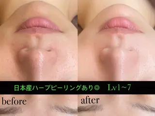 Eye Herb🌿 エステのエステ・リラクイメージ