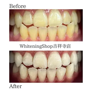 ホワイトニング ショップ吉祥寺店のエステ・リラクイメージ