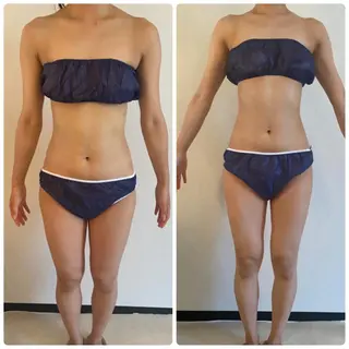 FLEUR大阪・整体 ・ハイフ・痩身・小顔のエステ・リラクイメージ