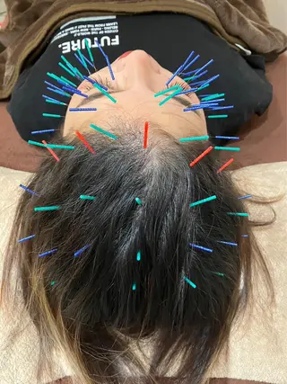 美容鍼灸女性専用 りんご鍼灸治療院のその他イメージ