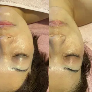 Meetite 小林のエステ・リラクイメージ