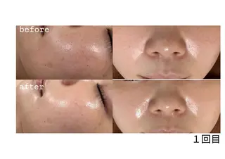 skinity所属・ピーリング専門サロン skinityのエステ・リラクイメージ