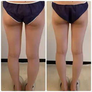 FLEUR大阪・整体 ・ハイフ・痩身・小顔のエステ・リラクイメージ