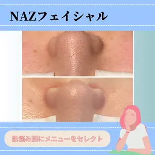 NAZ  (ナーズ)のエステ・リラクイメージ