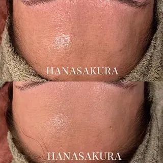 HANASAKURA所属・HANASAKURA 心斎橋のエステ・リラクイメージ