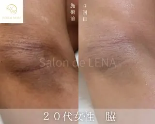 ハーブピーリング・毛穴ケア専門サロンSalon de LENA 名駅店所属・Salon  de LENA名駅店 白藤のエステ・リラクイメージ