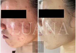 LUANA TAKAGIの眉毛・アイブロウイメージ