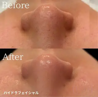 【京都市最安値】 salon YMのエステ・リラクイメージ
