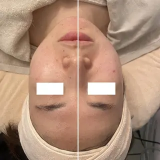 ✨美肌水光✨ アトリエリュバンのエステ・リラクイメージ