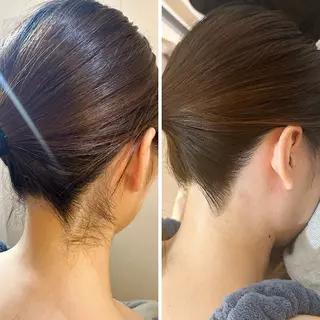 うなじ脱毛/美肌脱毛 LABELのエステ・リラクイメージ