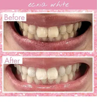 セルフホワイトニングサロン　エクシアホワイト西尾店所属・エクシアホワイト西尾 堀内恵のその他イメージ