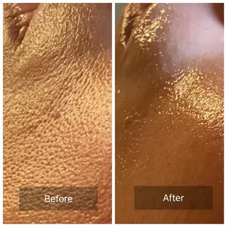 Mandarin Orange所属・毛穴から始める肌メン テマンダリンオレンジのエステ・リラクイメージ