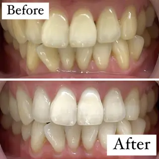 LBSホワイトニング 🌐渋谷店 小河原のエステ・リラクイメージ