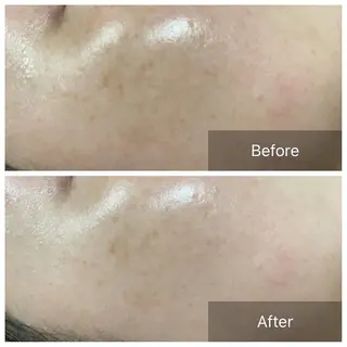 Lumiere despoir所属・Lumiere despoirのエステ・リラクイメージ