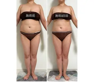 IBERIA心斎橋店 🌼凝り小顔美肌痩身のエステ・リラクイメージ