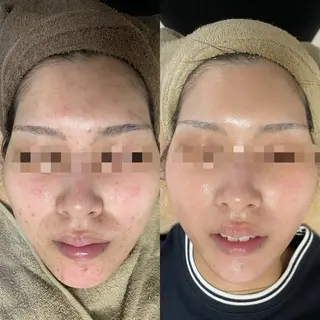 プライベートサロン Belle(ベル)のエステ・リラクイメージ