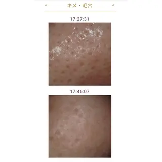 メナード瑞穂区平郷店 横山ともみのエステ・リラクイメージ