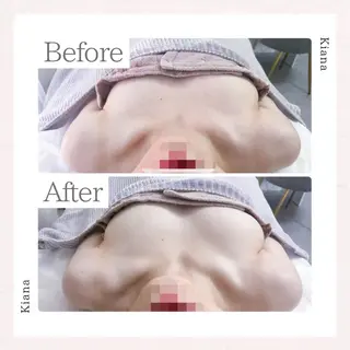 バスト専門Kiana 風のエステ・リラクイメージ