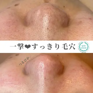 salon MUSUBUのエステ・リラクイメージ