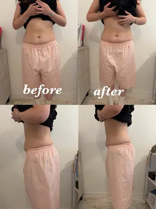 腸活サポート みなみののエステ・リラクイメージ