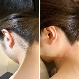 うなじ脱毛/美肌脱毛 LABELのエステ・リラクイメージ