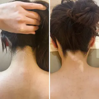 うなじ脱毛/美肌脱毛 LABELのエステ・リラクイメージ